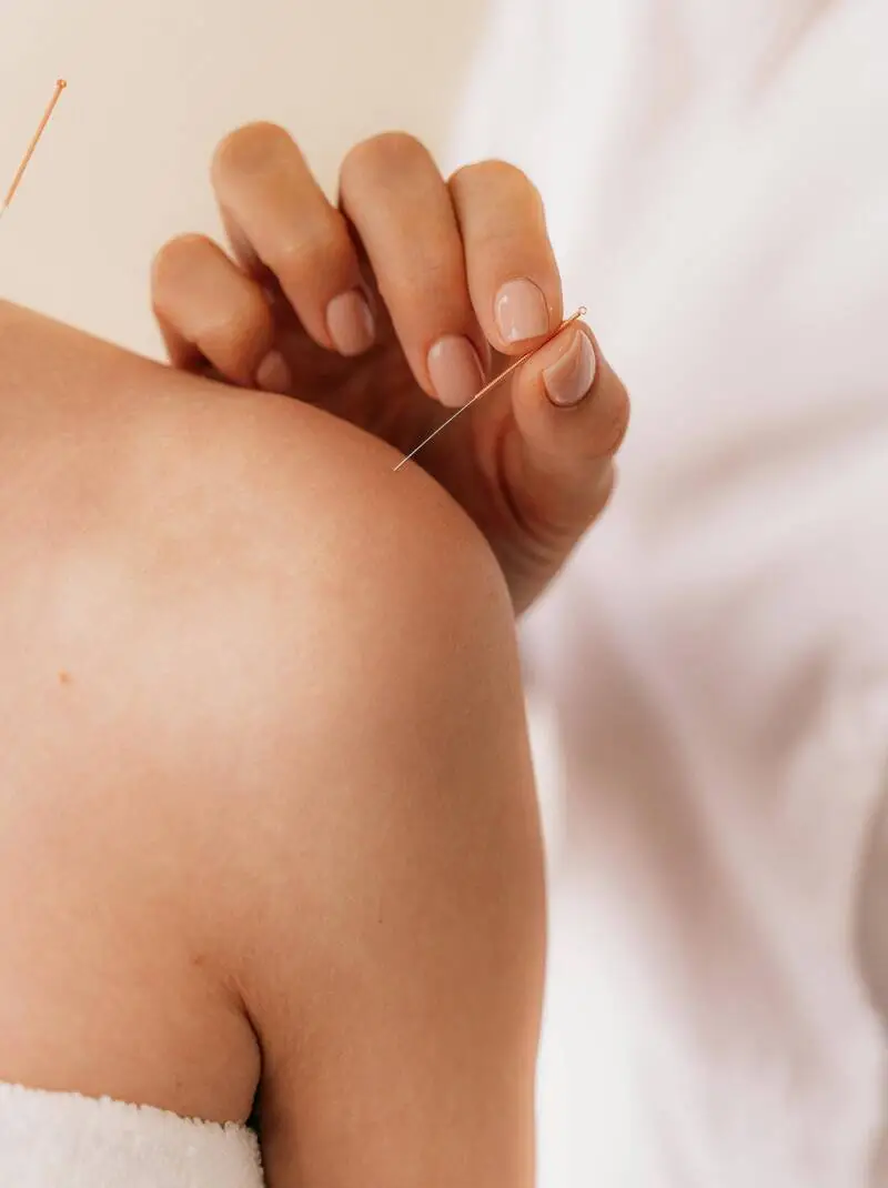 Brand New: Acupuncture
